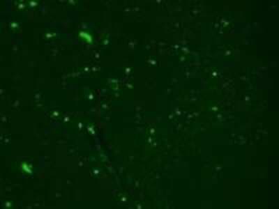 Immunocytochemistry/ Immunofluorescence: Nav1.7 Antibody (N68/6) [NBP2-12904]