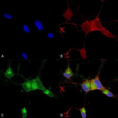 Immunocytochemistry/ Immunofluorescence: Nav1.7 Antibody (N68/6) [NBP2-12904]