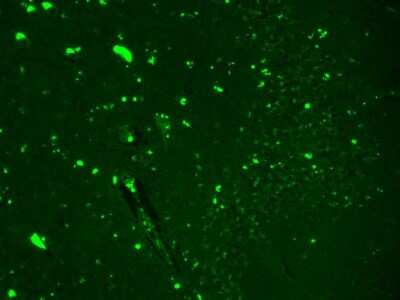 Immunohistochemistry: Nav1.7 Antibody (N68/6) [NBP2-12904]