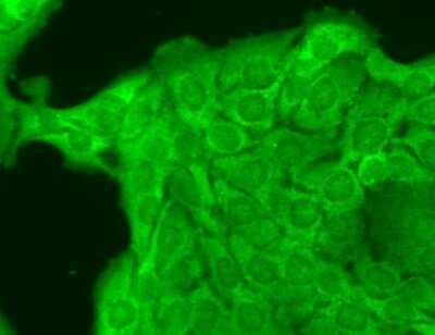 Immunocytochemistry/ Immunofluorescence: Nav1.8 Antibody (S134) [NBP1-47615]