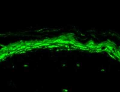 Immunocytochemistry/ Immunofluorescence: Nav1.8 Antibody (S134) [NBP1-47615]