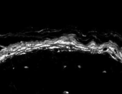 Immunohistochemistry: Nav1.8 Antibody (S134) [NBP1-47615]