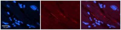 Immunohistochemistry-Paraffin: Nav1.5 Antibody [NBP2-86725]