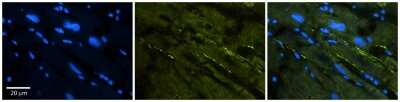 Immunohistochemistry-Paraffin: Nav1.5 Antibody [NBP2-86726]