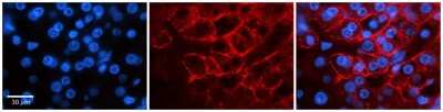 Immunohistochemistry-Paraffin: Nav1.6 Antibody [NBP2-84177]