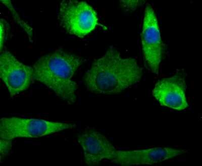Immunocytochemistry/ Immunofluorescence: Nav1.7 Antibody [NBP2-75581]