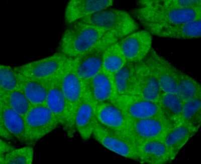 Immunocytochemistry/ Immunofluorescence: Nav1.7 Antibody [NBP2-75581]