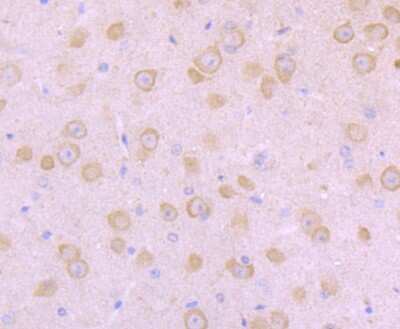 Immunohistochemistry-Paraffin: Nav1.8 Antibody [NBP2-75584]