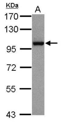 Western Blot: Nbs1 Antibody (1D7) [NB100-221]