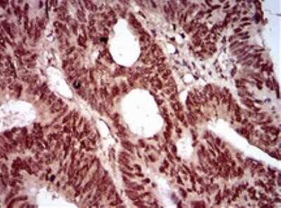 Immunohistochemistry: Nbs1 Antibody (7E4A2) - Azide and BSA Free [NBP2-80867]