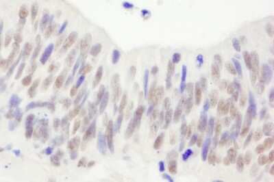 Immunohistochemistry-Paraffin: Nbs1 Antibody [NB100-60654]