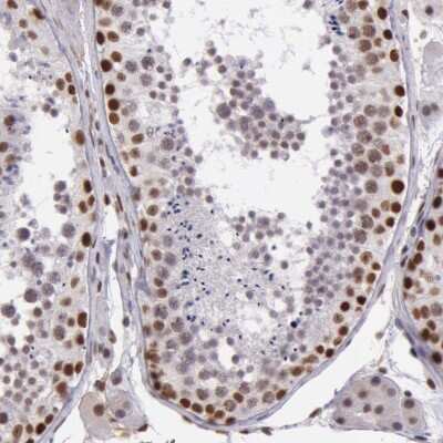 Immunohistochemistry-Paraffin: Nbs1 Antibody [NBP2-54661]