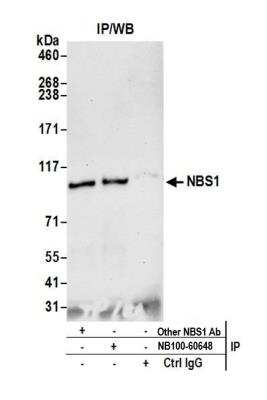 Immunoprecipitation: Nbs1 Antibody [NB100-60648]