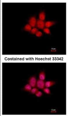 Immunocytochemistry/ Immunofluorescence: NCK1 Antibody [NBP2-19489]