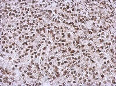 Immunohistochemistry-Paraffin: NCK1 Antibody [NBP2-19489]