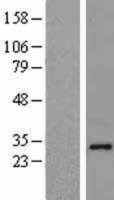 Western Blot: NDFIP1 Overexpression Lysate [NBL1-13525]
