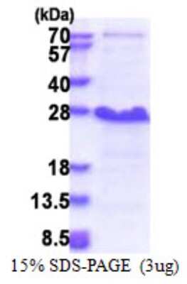 SDS-PAGE: Recombinant Human NDFIP1 His Protein [NBP2-23274]