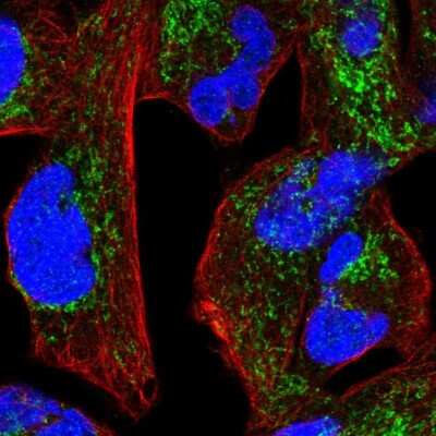 Immunocytochemistry/ Immunofluorescence: Ndufs1 Antibody [NBP2-56504]