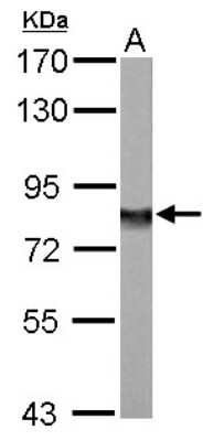 Western Blot: Ndufs1 Antibody [NBP1-31142]