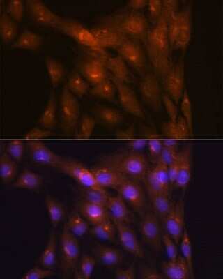 Immunocytochemistry/ Immunofluorescence: Ndufs4 Antibody (6T10F4) [NBP3-16679]