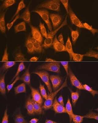 Immunocytochemistry/ Immunofluorescence: Ndufs4 Antibody (6T10F4) [NBP3-16679]