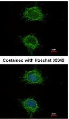 Immunocytochemistry/ Immunofluorescence: Ndufs4 Antibody [NBP1-31465]