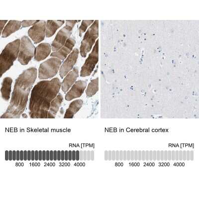 Immunohistochemistry-Paraffin: Nebulin Antibody [NBP1-87752]