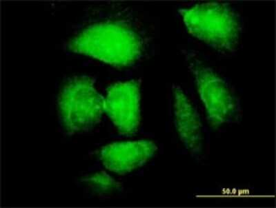 Immunocytochemistry/ Immunofluorescence: Necdin Antibody (1B3) [H00004692-M02]