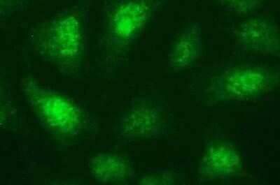 Immunocytochemistry/ Immunofluorescence: Necdin Antibody (OTI5D1) - Azide and BSA Free [NBP2-72925]