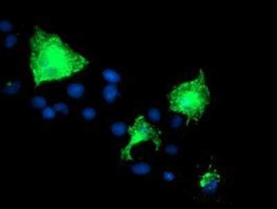 Immunocytochemistry/ Immunofluorescence: Nectin-1/PVRL1 Antibody (OTI6F8) - Azide and BSA Free [NBP2-72929]