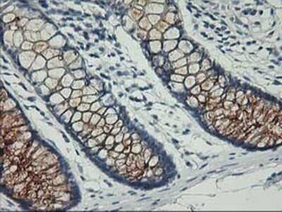 Immunohistochemistry: Nectin-1/PVRL1 Antibody (OTI6F8) - Azide and BSA Free [NBP2-72929]