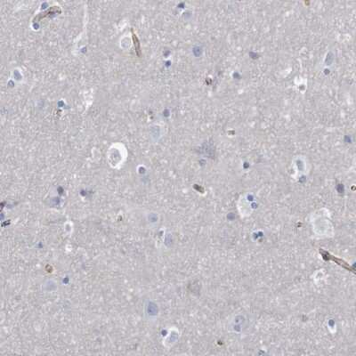 Immunohistochemistry-Paraffin: Nectin-2/CD112 Antibody [NBP1-91211]