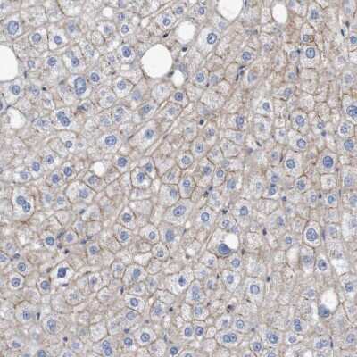 Immunohistochemistry-Paraffin: Nectin-2/CD112 Antibody [NBP1-91211]