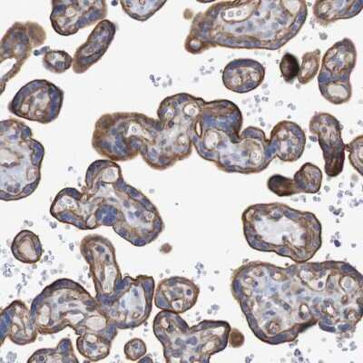 Immunohistochemistry-Paraffin: Nectin-2/CD112 Antibody [NBP1-91211]