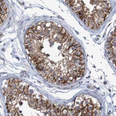 Immunohistochemistry-Paraffin: Nectin-2/CD112 Antibody [NBP1-91211]
