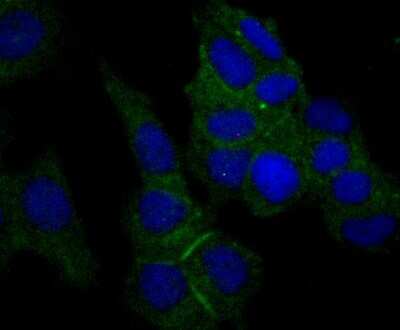 Immunocytochemistry/ Immunofluorescence: Nectin-2/CD112 Antibody (JG39-64) [NBP2-76852]