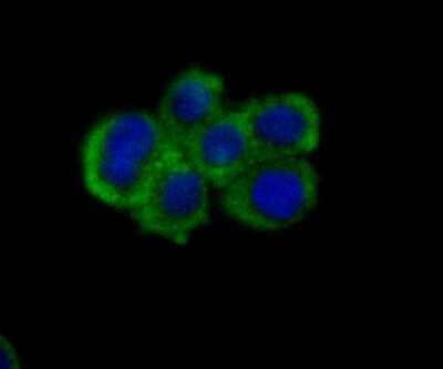 Immunocytochemistry/ Immunofluorescence: Nectin-2/CD112 Antibody (JG39-64) [NBP2-76852]
