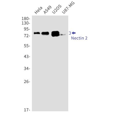 Western Blot: Nectin-2/CD112 Antibody (S07-7G6) [NBP3-20071]