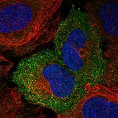 Immunocytochemistry/ Immunofluorescence: Nectin-4/PVRL4 Antibody [NBP1-82829]