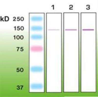 Western Blot: Nephrin Antibody (Y17-R) [NBP1-30130]