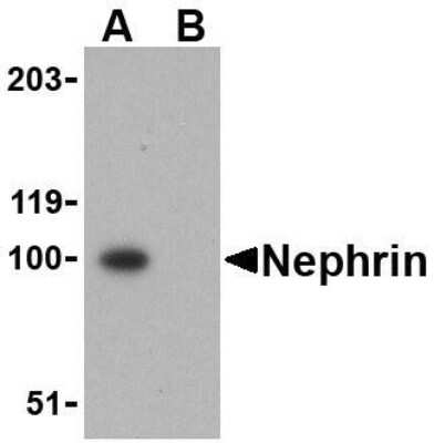 Western Blot: Nephrin AntibodyBSA Free [NBP1-77303]