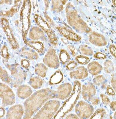 Immunohistochemistry-Paraffin: Nephronophthisis Antibody - Azide and BSA Free [NBP2-94059]