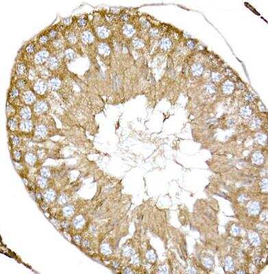 Immunohistochemistry-Paraffin: Nephronophthisis Antibody - Azide and BSA Free [NBP2-94059]