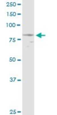 Western Blot: Nephronophthisis Antibody [H00004867-D01P]
