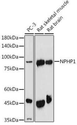 Western Blot: Nephronophthisis AntibodyAzide and BSA Free [NBP2-94059]