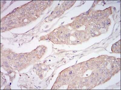 Immunohistochemistry: Neprilysin/CD10 Antibody (5E9A5) - BSA Free [NBP2-37301]