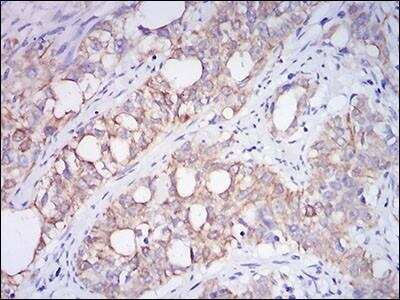 Immunohistochemistry-Paraffin: Neprilysin/CD10 Antibody (7D4B1) - BSA Free [NBP2-37303]