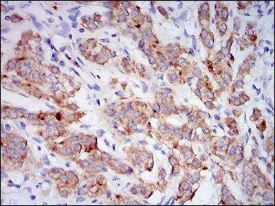 Immunohistochemistry-Paraffin: Neprilysin/CD10 Antibody (7D4B1) - BSA Free [NBP2-37303]
