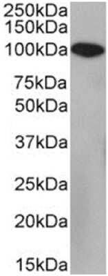 Western Blot: Neprilysin/CD10 Antibody (FR4D11)ChimericAzide and BSA Free [NBP3-12068]