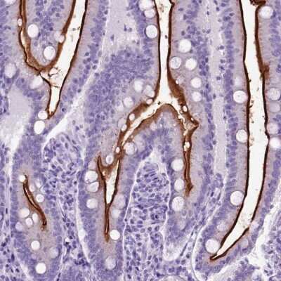 Immunohistochemistry: Neprilysin/CD10 Antibody [NBP2-48701]